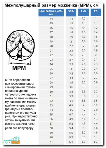 Mărimea săptămâni cerebeloase fetale (valoarea acestui termen) Dimensiunea cerebelului fetale de saptamana