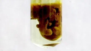 Uita-te la video de soluție de sare de 10 la suta modul de a face gratuit (interes) Uita-te la o soluție de sare de 10 la suta video de modul de a face gratuit