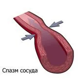 Vasculare simptome picioare, probleme
