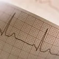 bai uscate de dioxid de carbon, articole - Centrul Medical-clinici Guța (uscat) bai bioxid de carbon uscat, articole - clinici Medical Center Guță