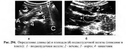 Examinarea cu ultrasunete a pancreasului (pancreatic) Examinarea cu ultrasunete a pancreasului