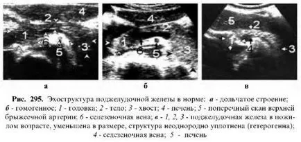 Examinarea cu ultrasunete a pancreasului (o glanda) Examinarea cu ultrasunete a pancreasului