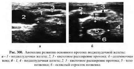 Examinarea cu ultrasunete a pancreasului (de cercetare) Examinarea cu ultrasunete a pancreasului