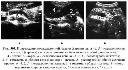 Examinarea cu ultrasunete a pancreasului (ultrasunete) Examinarea cu ultrasunete a pancreasului