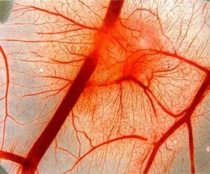 Vasculita diagnostic, simptomele și tratamentul remedii populare (simptome) Vasculita diagnostic, simptome și tratament de atac folk