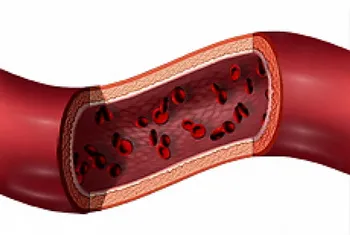 Vasculita tratament - tratamentul inimii (inflamație a pereților de sânge) Tratamentul Vasculita - tratamentul inimii