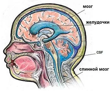 Ventriculomegalie - întreruperea sau terapie (tratament) Ventriculomegalie - întreruperea sau tratamentul