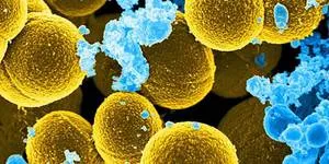 Tipuri și simptome de metode de diagnostic și tratament stafilococilor, precum și ce pericolele sale și modul în care el