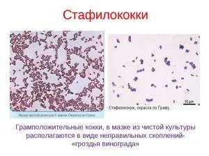 Tipuri și simptome de metode de diagnostic și tratament stafilococilor, precum și ce pericolele sale și modul în care el