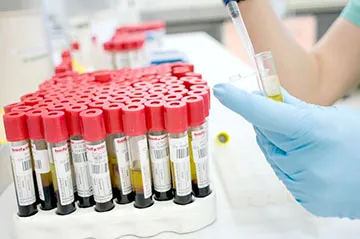 Cum de a verifica hormonii