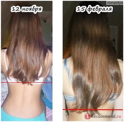 Vitamine injecție de acid nicotinic - (! Diferența de 4 luni) „fotografii înainte și după par