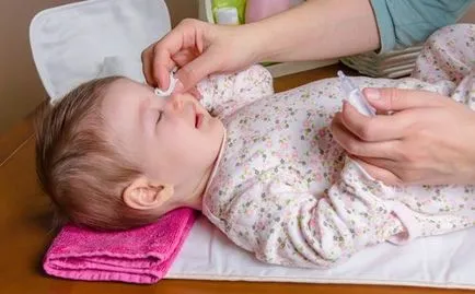 Orzul în fața unui copil cauze si tratament cu medicamente și remedii populare (urcior)