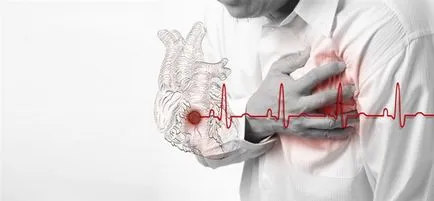 Ceea ce este diferit de un accident vascular cerebral atac de cord