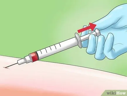 Cum să vă o injecție intravenoasă face