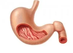 Gastro și tratamentul acesteia