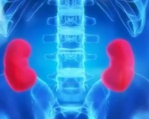 glomerulonefrita-l