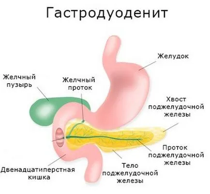 Gastro și tratamentul acesteia