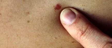 Cum de a aduce un mol