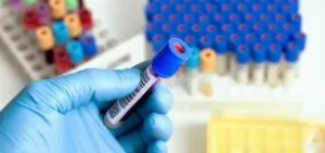 Cum de a verifica glandei suprarenale