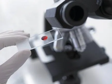 Cum de a verifica glandei suprarenale