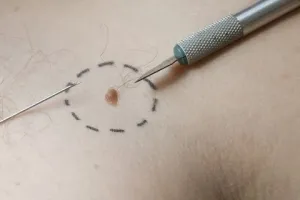 Cum de a aduce un mol