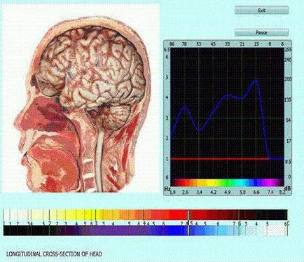 Diagnosticare de organism ce este