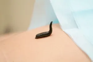 Adeziuni cum să-l trateze Adeziuni cum să-l trateze
