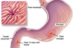 Imagistica a stomacului, care este Imagistica a stomacului, care este