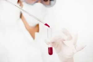 Hemoglobina cum să trateze Hemoglobina cum să trateze