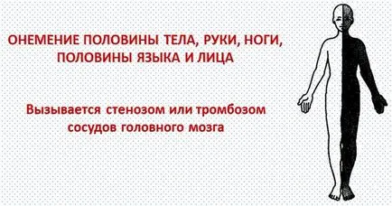 Tratamentul de amorțeală la nivelul membrelor