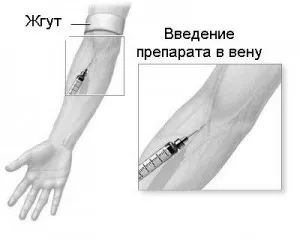 Cum să vă o injecție intravenoasă face Cum să vă o injecție intravenoasă face