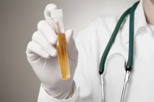 Cum de a crește celulele albe din sânge în urină Cum de a crește celulele albe din sânge în urină