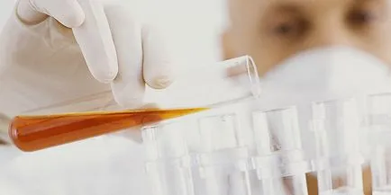 Cum de a crește celulele albe din sânge în urină Cum de a crește celulele albe din sânge în urină