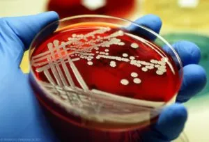 Tratamentul Staphylococcus aureus în nas