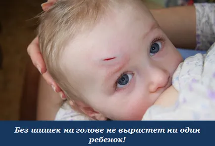 comoție cerebrală într-un tratament de copil