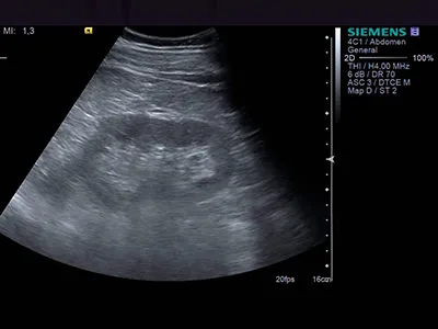 Ultrasunete a sistemului genito-urinar Ultrasunete a sistemului genito-urinar