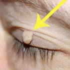 Ce dă adrenalina Ce dă adrenalina