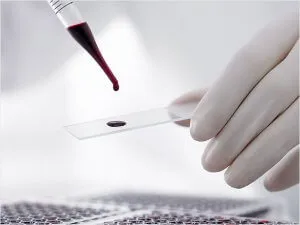 Cum de a identifica boli infecțioase