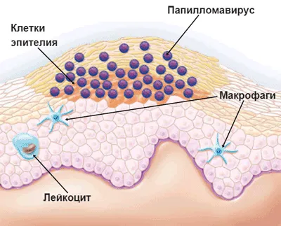 Cum obțineți HPV Cum obțineți HPV