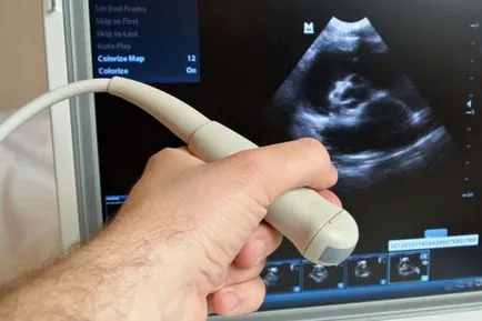Ultrasunete a sistemului genito-urinar