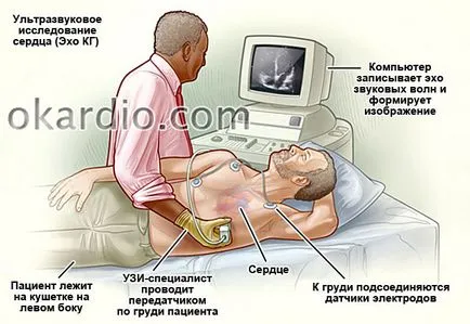 PAM anevrism (septal atrial) la adulți și copii
