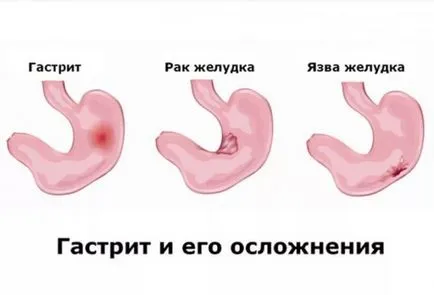 Antrum în cazul în care, departamente, diagnosticare (departament) Antrum în cazul în care, departamente, diagnosticare