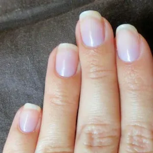 Biogel în casă, blog-ul feminin - sanatate site-ul si frumusete