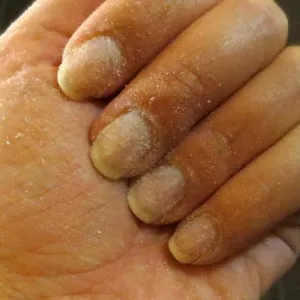 Biogel în casă, blog-ul feminin - sanatate site-ul si frumusete