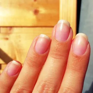 Biogel în casă, blog-ul feminin - sanatate site-ul si frumusete