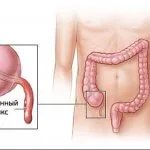Ceea ce este în partea stângă a unei persoane, și că nu pot fi bolnav (partea) Ceea ce se află în partea stângă a unei persoane, și că ar putea fi bolnav