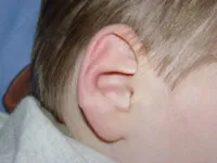 Ce se poate face în cazul în care un copil nu poate auzi nu aude sau nu vrea să audă (auzi) Ce se poate face în cazul în care un copil nu poate auzi nu aude sau nu vrea să audă