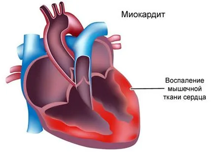 Bate-l, cauze, simptome, diagnostic și tratament