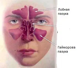 Simptomele sinuzitei, cauzele si tratamentul sinuzita (simptome) simptome sinuzită, cauzele si tratamentul sinuzitei