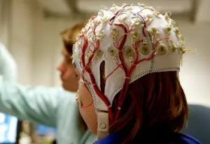 Idiopatica epilepsie clasificare, diagnostic, tratament